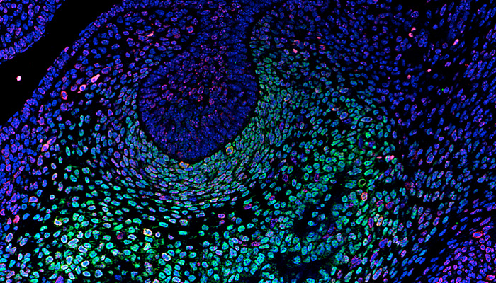 Meta Diseases and Membrane Trafficking Disorders Bolic