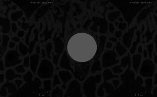 MicroCT Core